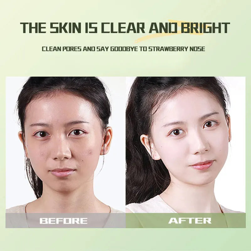 LAIKOU Green Tea Mud Face Mask – Deep Cleansing & Pore Minimizing