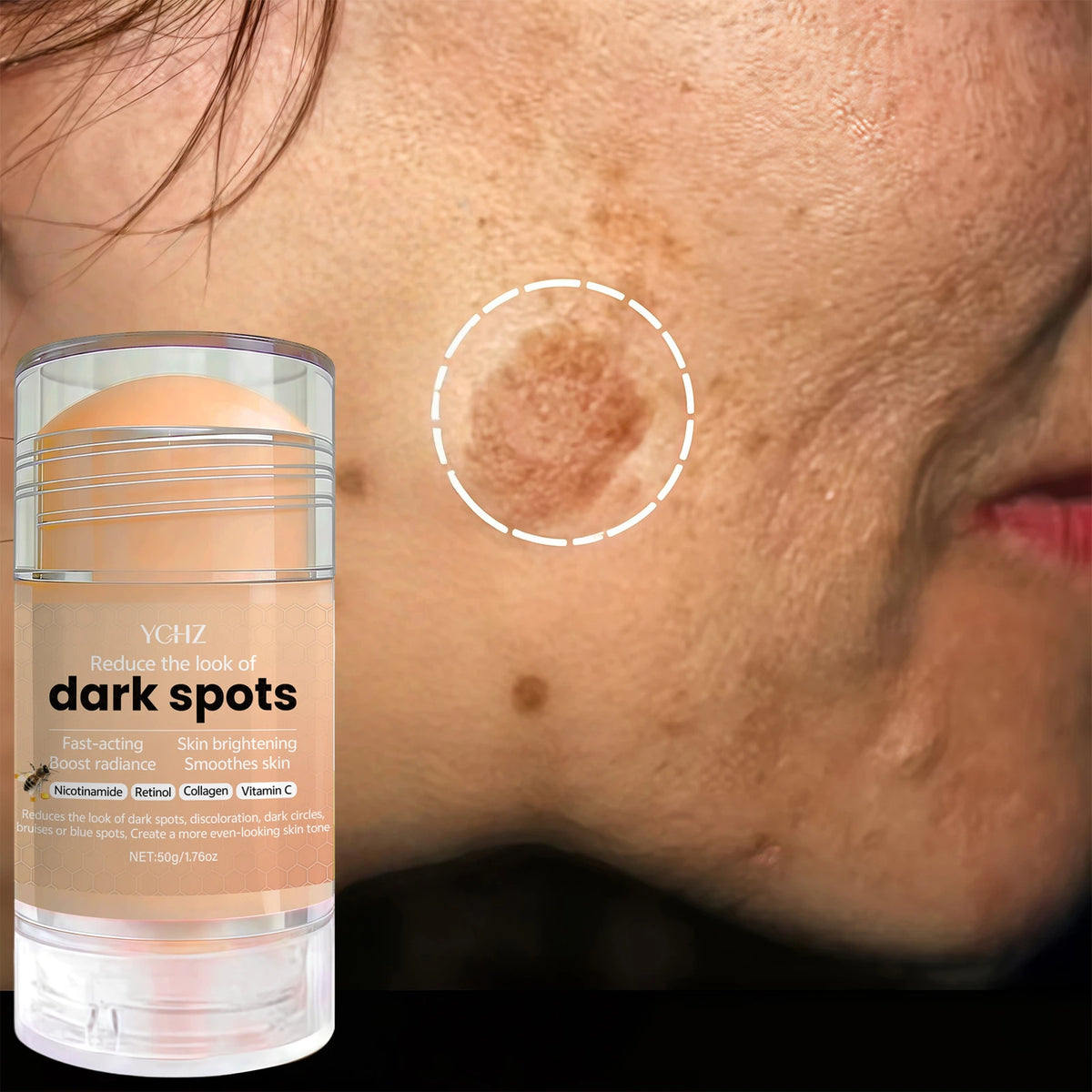YCHZ Skin Brightening Cream – Even Tone & Dark Spot Reducer