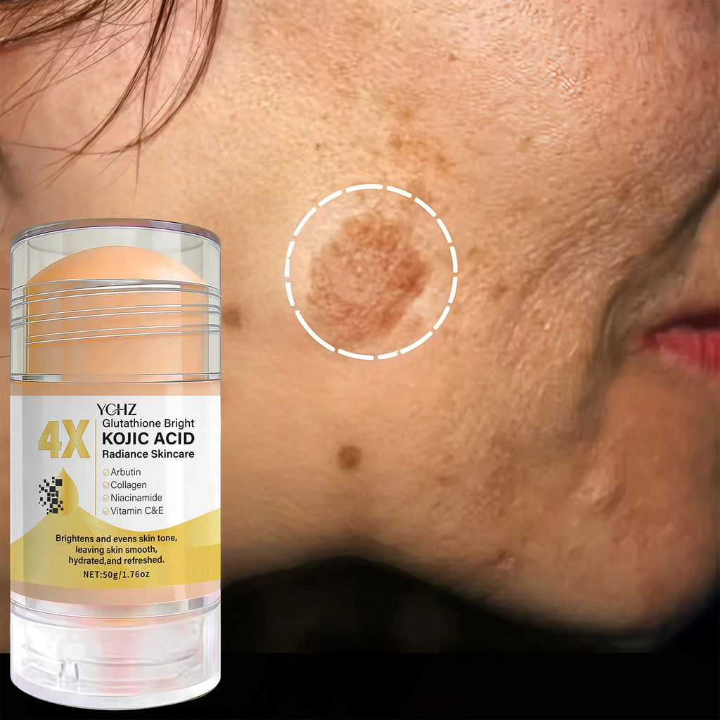 Kojic Acid Cream Stick – Dark Spot Corrector & Brightener 50g