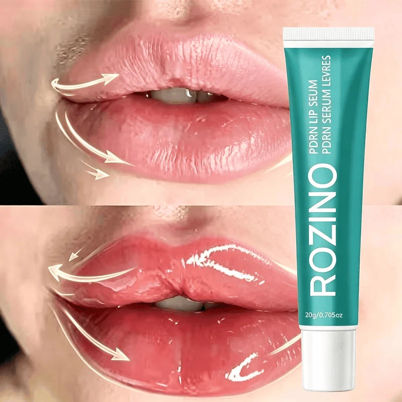 ROZINO PDRN Plumping Lip Serum | Hydrating Lip Balm & Oil