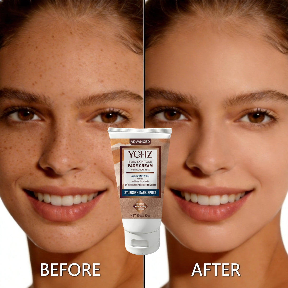 YCHZ Niacinamide Brightening Cream – Dark Spot & Tone Cream