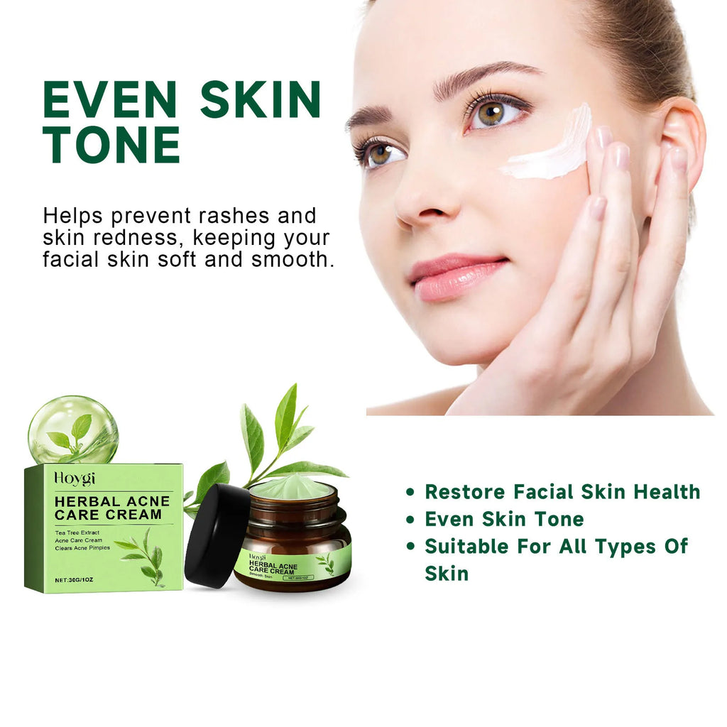 Hoygi Acne Face Cream & Serum Set – Oil Control & Pore Care