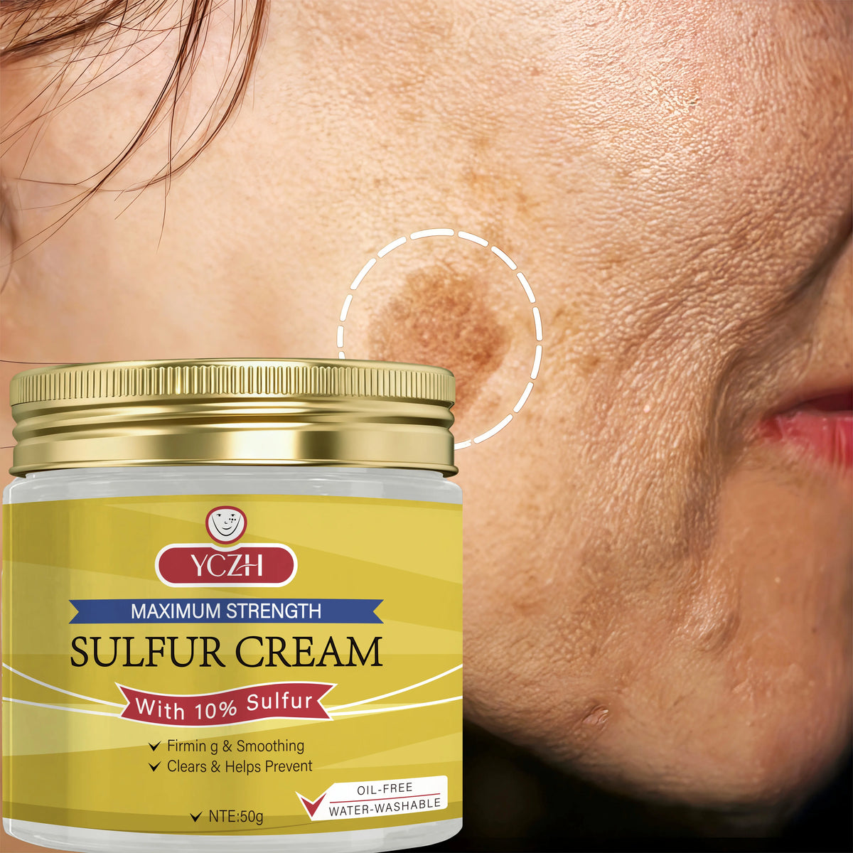 YCHZ Sulfur Cream – Pore Minimizing & Skin Firming | 50g