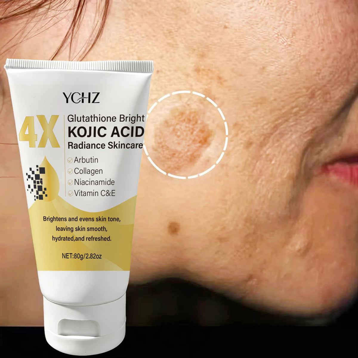YCHZ Kojic Acid Face Cream 80g – Brighten & Even Skin Tone
