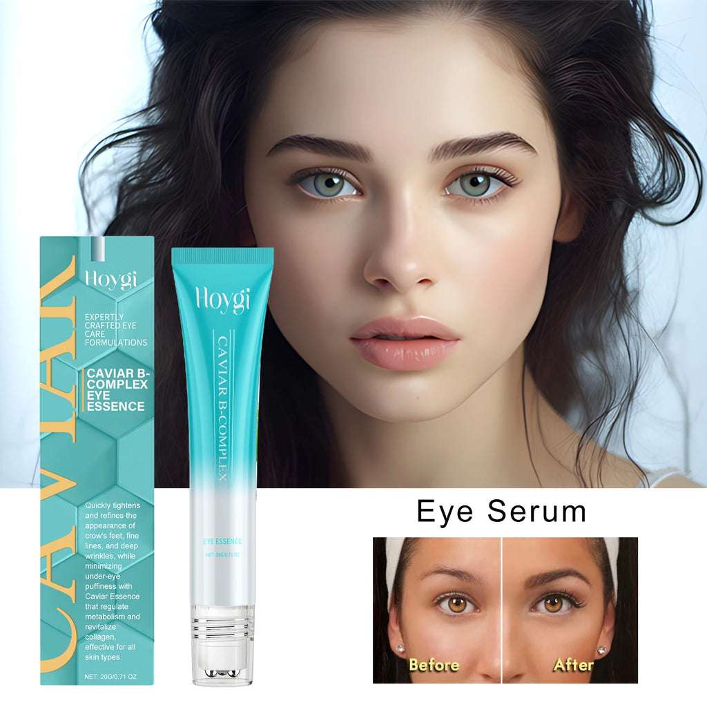 Hoygi Caviar Eye Essence – Firming & Brightening Eye Serum