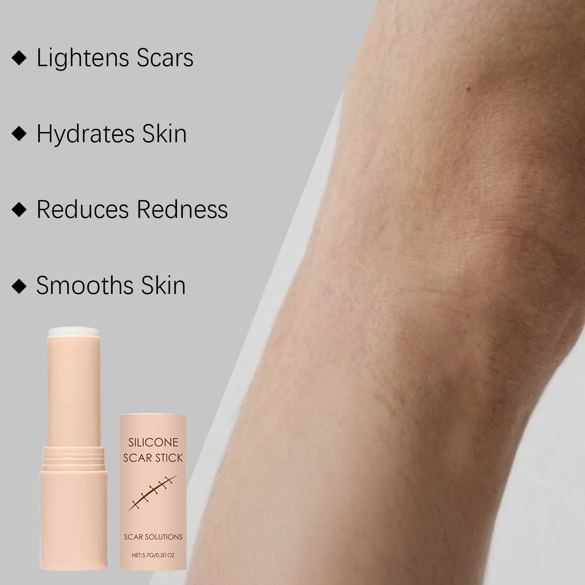 Silicone Scar Stick – Smoothing & Moisturizing Skin Care 5.7g