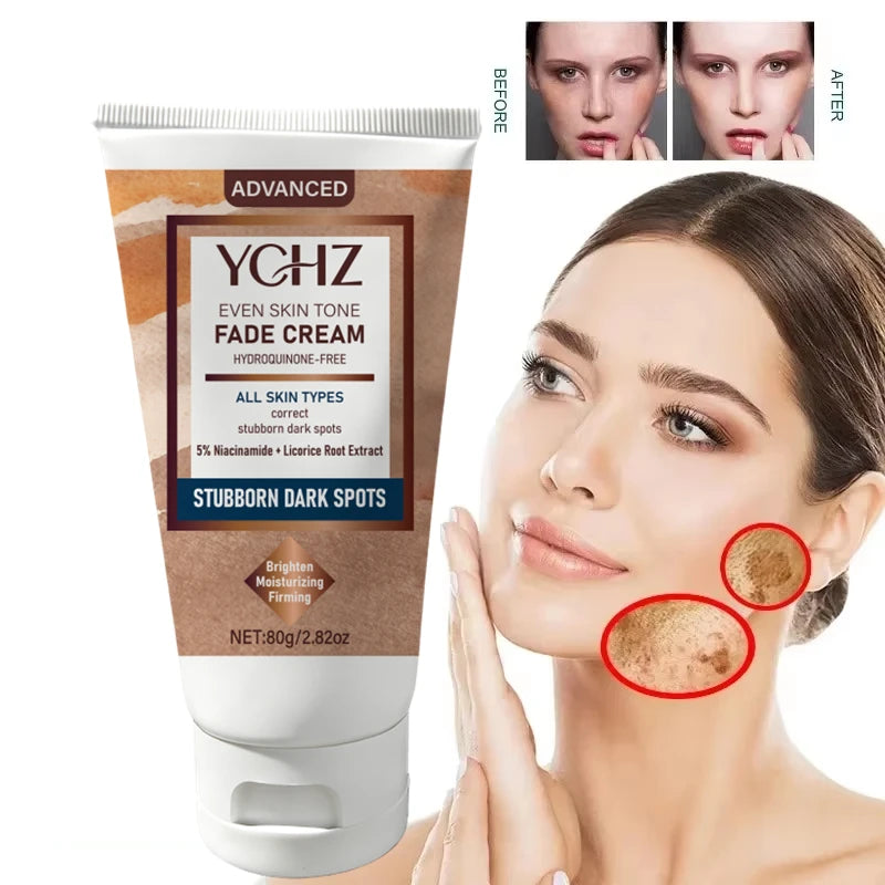 YCHZ Niacinamide Brightening Cream – Dark Spot & Tone Cream