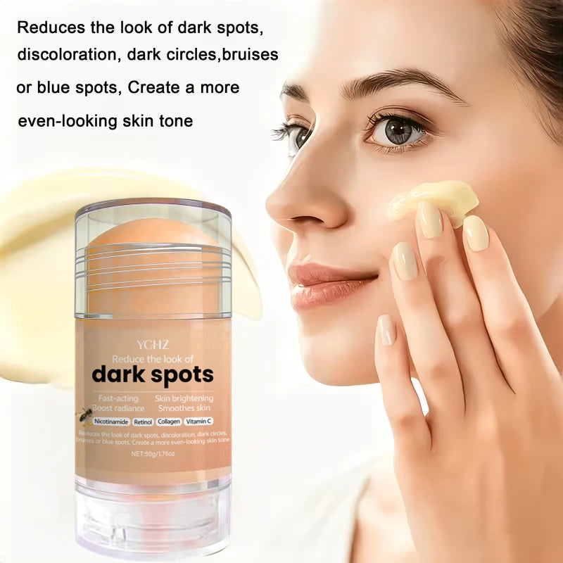 YCHZ Skin Brightening Cream – Even Tone & Dark Spot Reducer