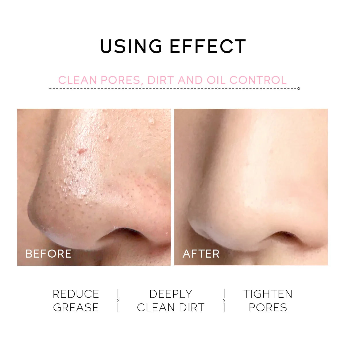 LAIKOU Sakura Peel-Off Nose Mask – Deep Cleanse & Pore Care