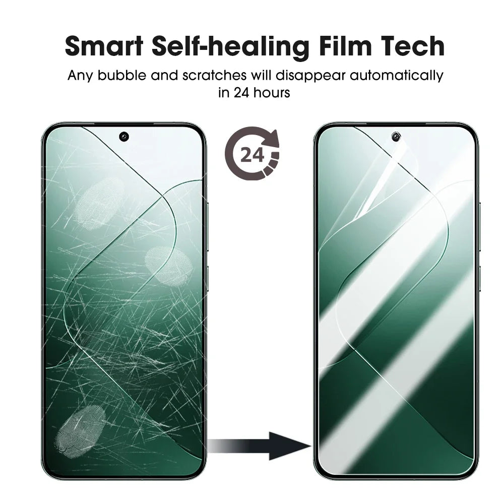 Xiaomi Mi 14 / 14 Pro HD Hydrogel Screen Protector – 5-Pack