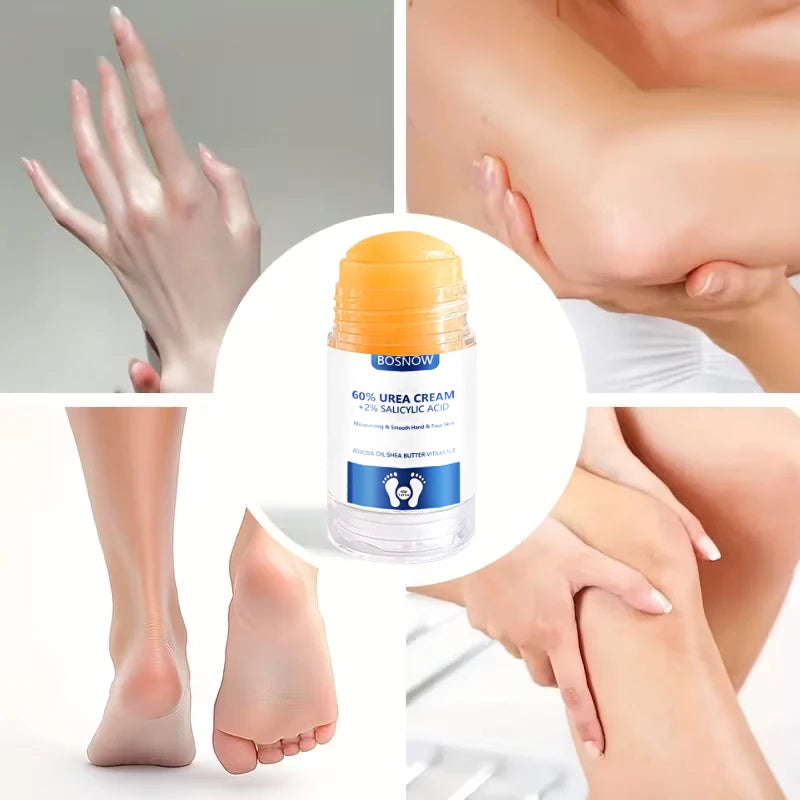Bosnow 60% Urea & Salicylic Acid Hand & Foot Stick – 40g