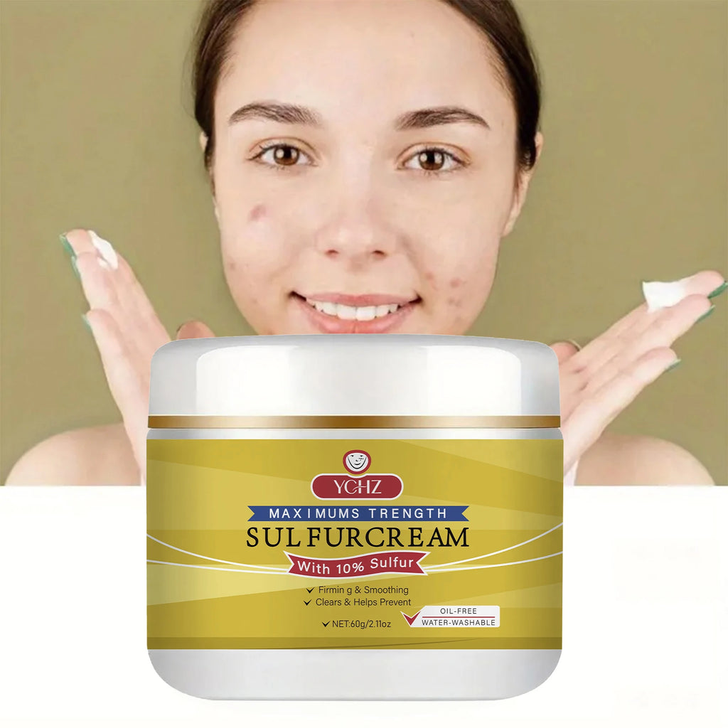 YCHZ Sulfur Face Cream – Brightening & Moisturizing 60g