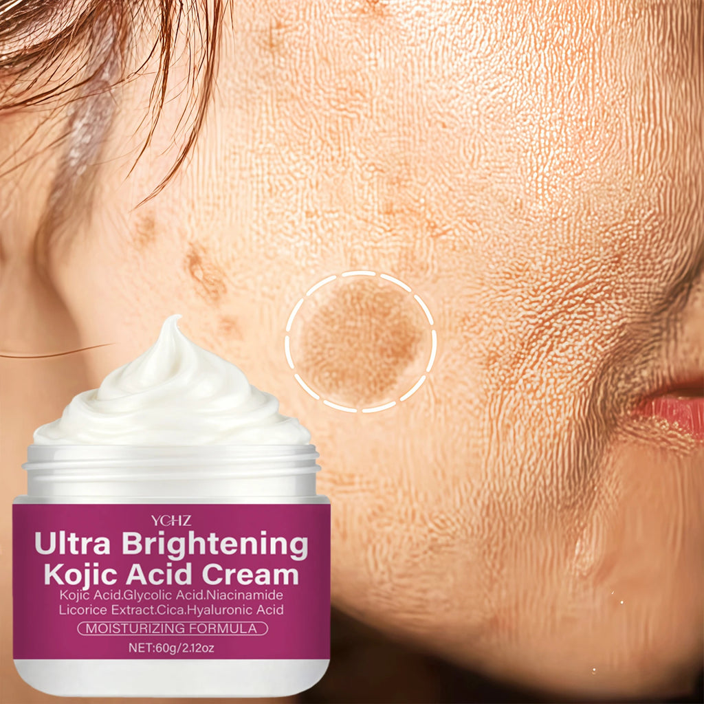 Kojic Acid Brightening Cream – Niacinamide, Vitamin C & E