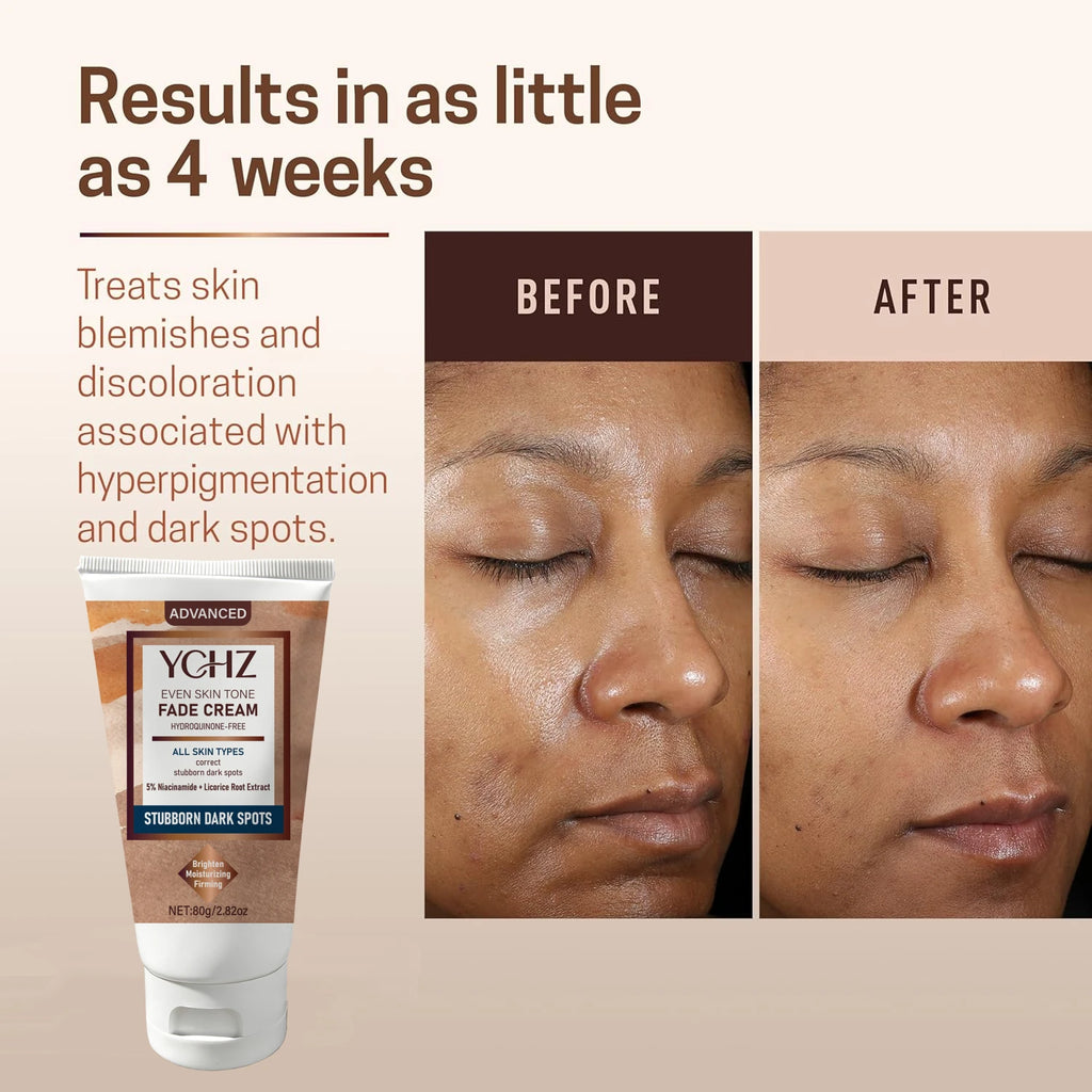 YCHZ Niacinamide Brightening Cream – Dark Spot & Tone Cream