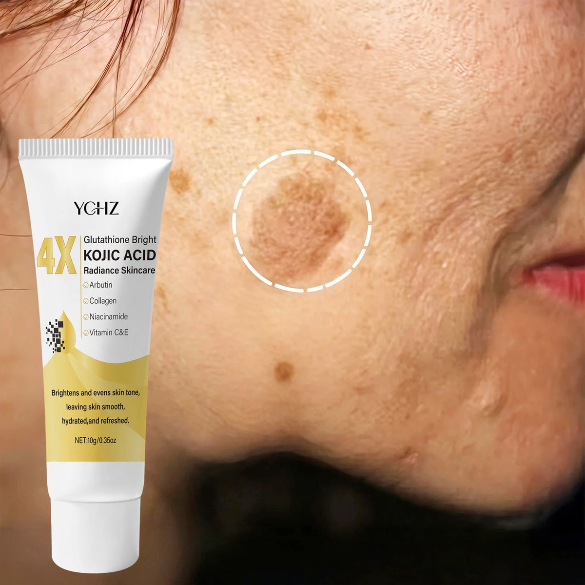 YCHZ Kojic Acid Face Cream – Dark Spot & Skin Tone Cream