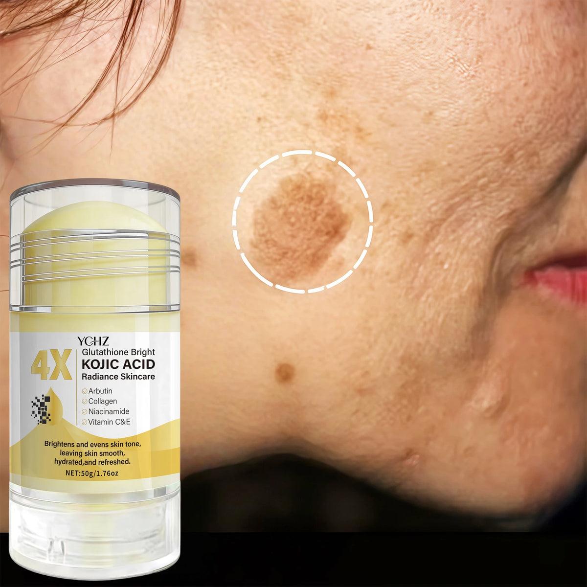 Kojic Acid Cream Stick – Brighten Skin & Fade Dark Spots 50g