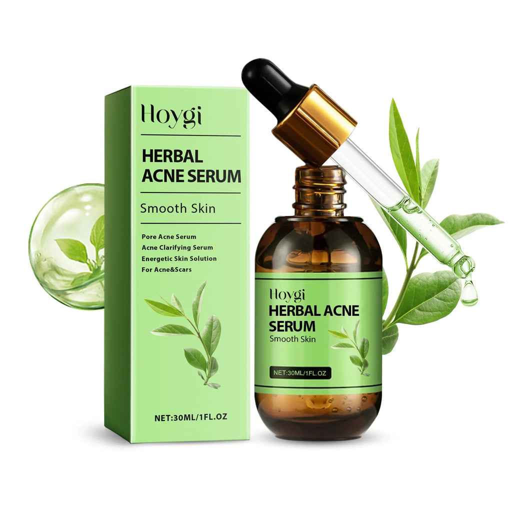 Hoygi Acne Face Cream & Serum Set – Oil Control & Pore Care