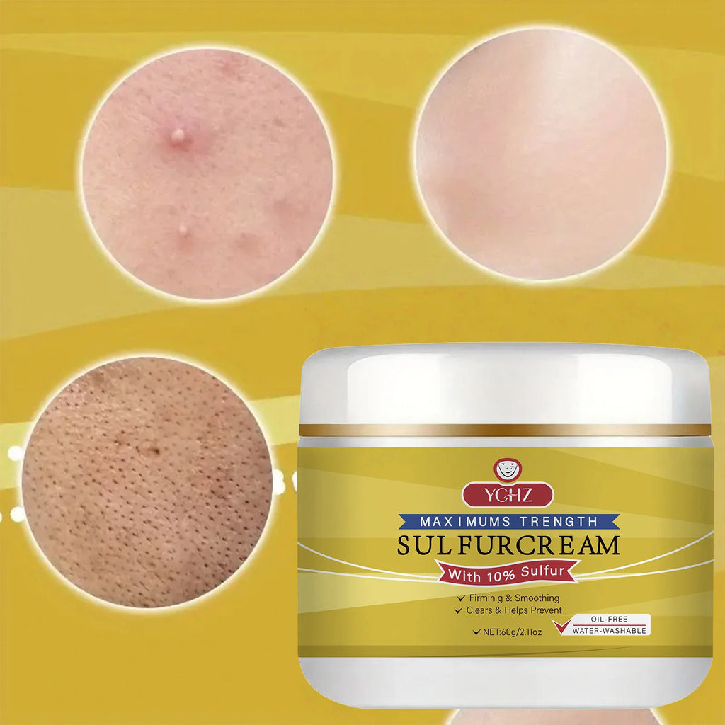 YCHZ Sulfur Face Cream – Brightening & Moisturizing 60g