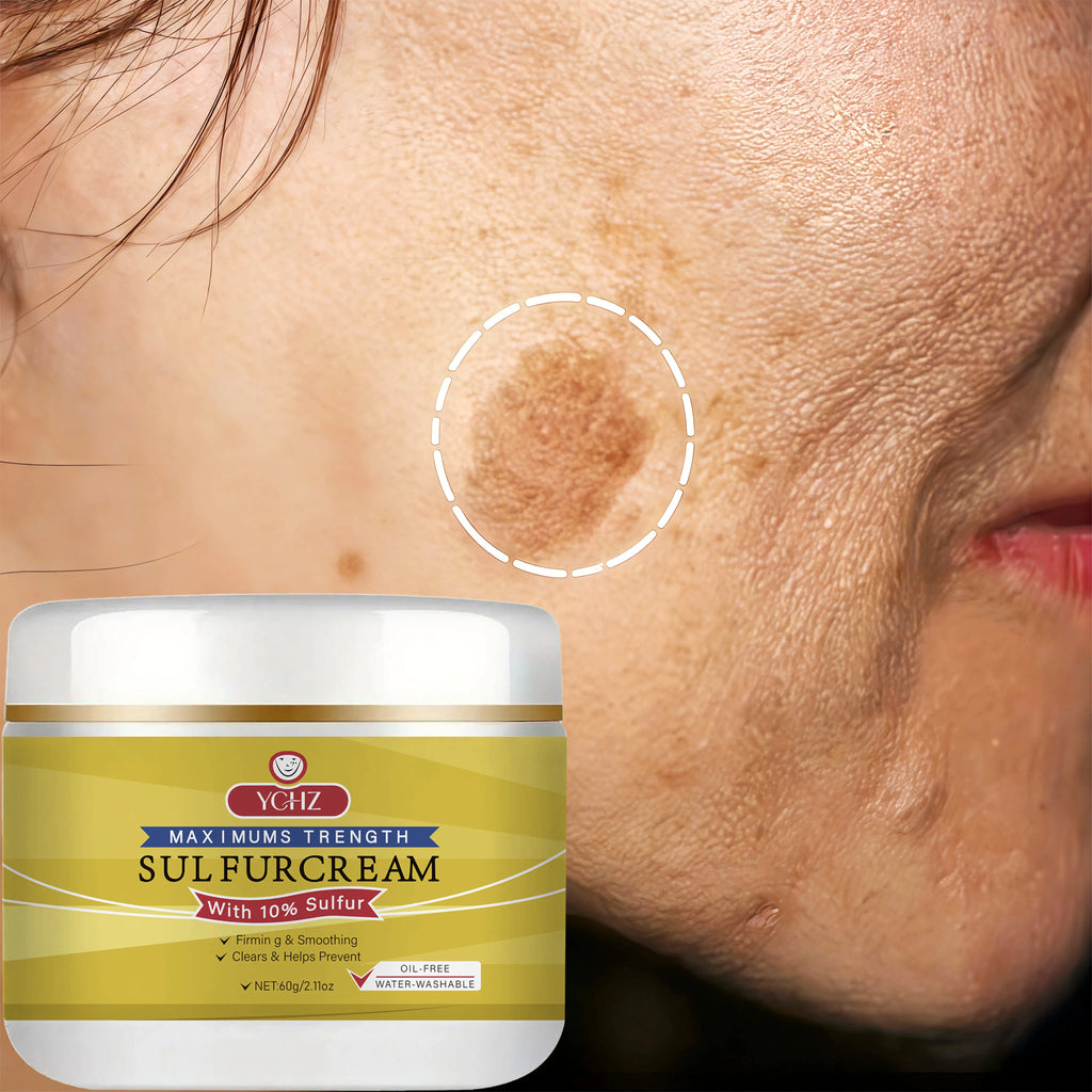 YCHZ Sulfur Face Cream – Brightening & Moisturizing 60g