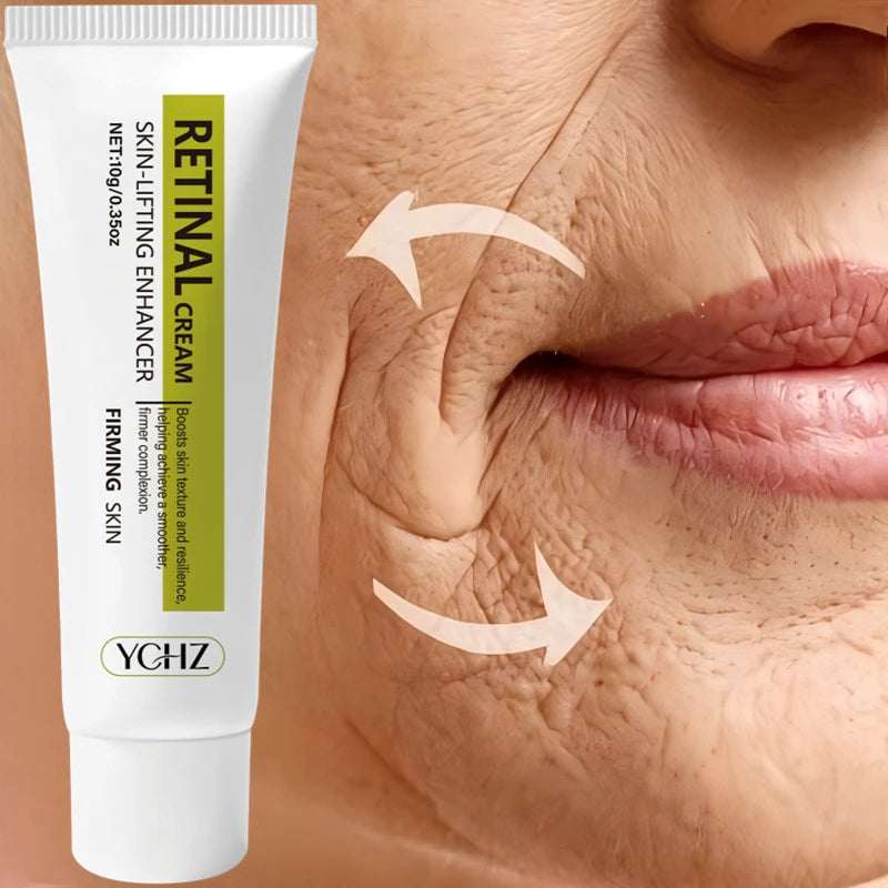 YCHZ Retinol Firming Eye Cream – Hydrating, 10g | Unisex
