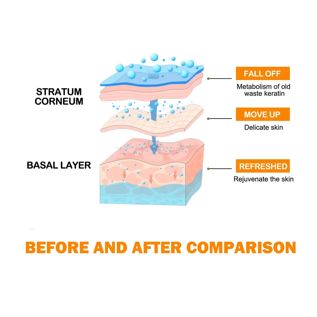 Hoygi Exfoliating Peeling Gel – Pore Tightening & Blackhead Remover