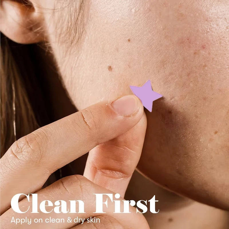 ROZINO 840-Pc Star Hydrocolloid Acne Patches – Colorful Face Stickers