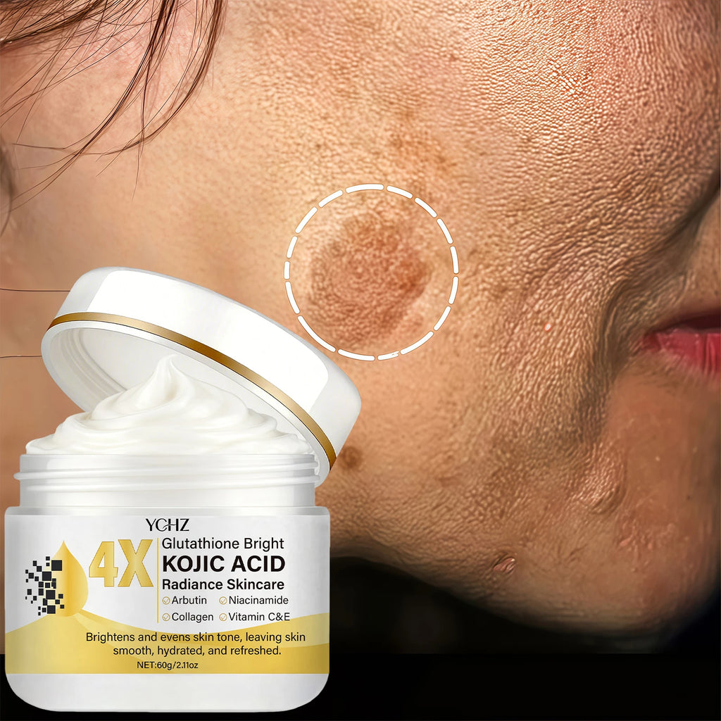 YCHZ Kojic Acid Face Cream – Brightening & Moisturizing 60g