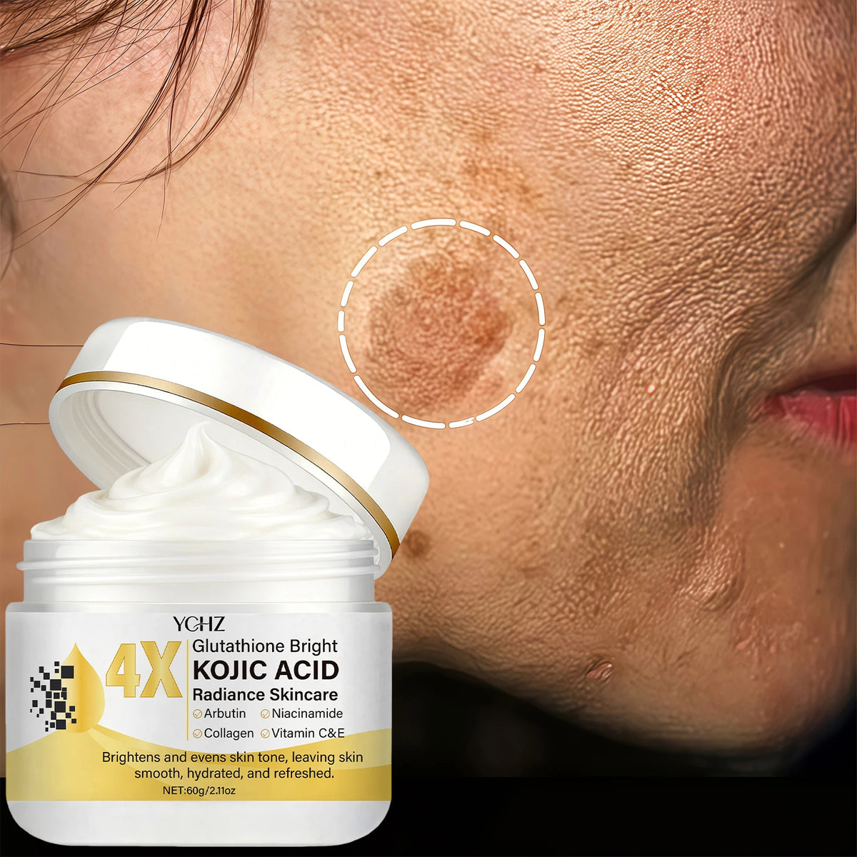 YCHZ Kojic Acid Face Cream – Brightening & Moisturizing 60g